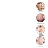 اتو 3 حالته فراصوت صورت جوانساز و لایه بردار عمیق پوست SKIN