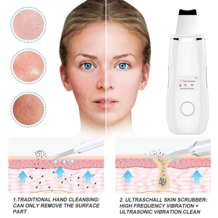 اتو 3 حالته فراصوت صورت جوانساز و لایه بردار عمیق پوست SKIN