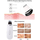 اتو 3 حالته فراصوت صورت جوانساز و لایه بردار عمیق پوست SKIN