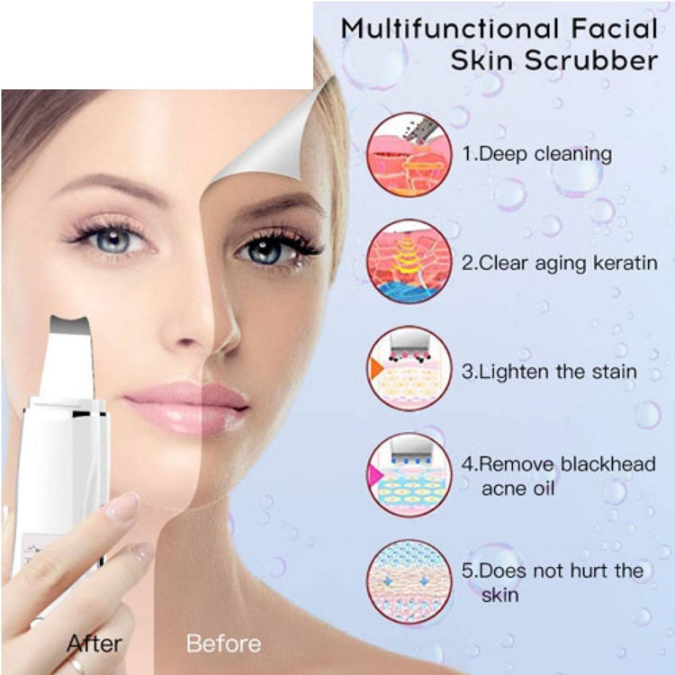اتو 3 حالته فراصوت صورت جوانساز و لایه بردار عمیق پوست SKIN